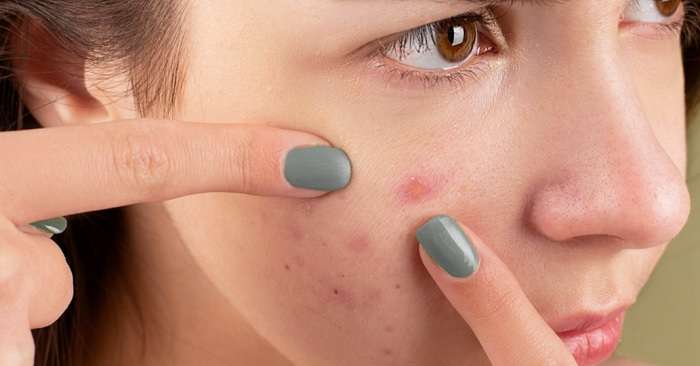 Dermaplaning At Home Common Mistakes To Avoid Damaged