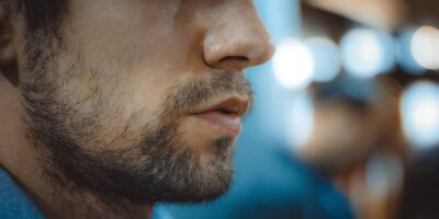 Patchy Beard Problems: 10 Ways to Deal With and Make the Most of It